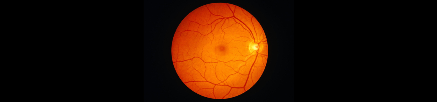 Eye lens eye clinic image